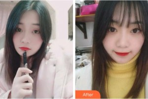 溫州醫(yī)科大學附屬口腔學院魏利敏整形價格表附牙齒隱形矯正案例展示