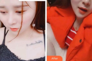 溫州醫(yī)科大學附屬口腔學院梅麗琴整形價格表附超聲波潔牙案例展示