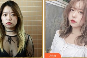 溫州醫(yī)科大學附屬眼視光醫(yī)院沈麗君整形價格表附眼部綜合案例展示