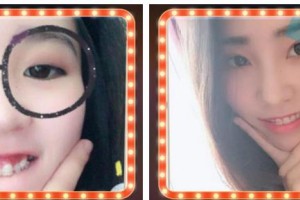 溫州醫(yī)科大學附屬眼視光醫(yī)院傅亞娜整形價格表附牙齒陶瓷矯正案例展示