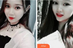 溫州藍芽口腔門診部楊新新整形價格表附牙齒隱形矯正案例展示