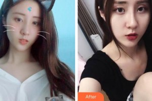 嘉興華山醫(yī)療美容醫(yī)院朱凌賢整形價格表附激光祛斑案例展示