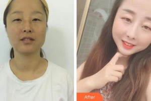 嘉興華山醫(yī)療美容醫(yī)院郭豪整形價格表附白瓷娃娃案例展示