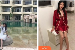 湖州曙光醫(yī)療美容門診部范菁整形價(jià)格表附白瓷娃娃案例展示