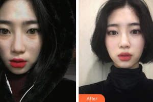 深圳賀五洲醫(yī)療美容診所賀五洲整形價(jià)格表附光子嫩膚案例展示