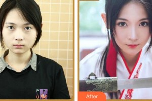 紹興愛爾眼科醫(yī)院閔宗英整形價(jià)格表附眼部綜合案例展示