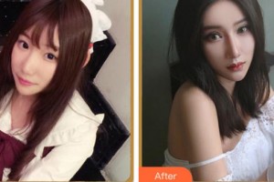 紹興愛爾眼科醫(yī)院王曉瑛整形價(jià)格表附眼部綜合案例展示