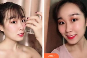 紹興越中口腔醫(yī)院傅仁林整形價(jià)格表附冷光美白案例展示