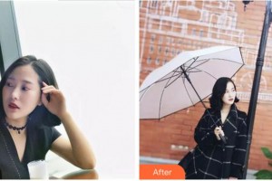 紹興市口腔醫(yī)院王曉玲整形價(jià)格表附牙貼面案例展示