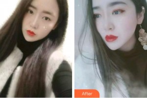 金華口腔醫(yī)院馬國強(qiáng)整形價(jià)格表附金屬托槽矯正案例展示