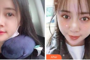 金華周亞軍口腔門診部馬永太整形價格表附自鎖托槽矯正案例展示