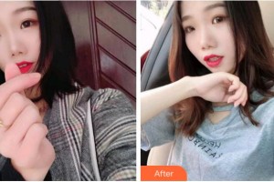 金華周亞軍口腔門診部何兆浦整形價格表附牙齒隱形矯正案例展示