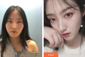 臺州骨傷醫(yī)院整形美容科張靈芝整形價格表附鼻部綜合案例展示