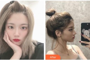 臺州仁登醫(yī)療美容門診部林峰整形價格表附鼻部綜合案例展示