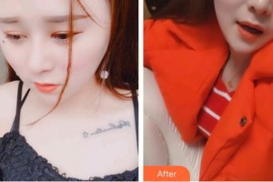 臺州牙科醫(yī)院齊淑敏整形價格表附超聲波潔牙案例展示