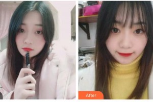 臺(tái)州拜博口腔醫(yī)院王學(xué)俠整形價(jià)格表附牙齒隱形矯正案例展示