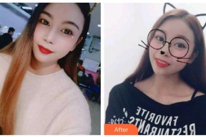 臺(tái)州康貝佳口腔醫(yī)院趙承煥整形價(jià)格表附牙貼面案例展示