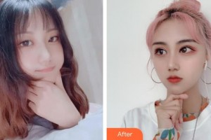 臺(tái)州國際眼科醫(yī)院江秋若住院醫(yī)師整形價(jià)格表附眼部綜合案例展示