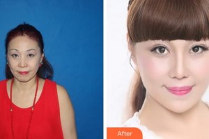 四川美萊醫(yī)學(xué)美容醫(yī)院蒙潔整形價(jià)格表附埋線提升案例展示