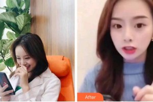 四川大學(xué)華西口腔醫(yī)院美容中心黃俊整形價格表附超聲波潔牙案例展示