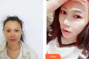 四川圣麗整形美容醫(yī)院肖開宇整形價(jià)格表附光子嫩膚案例展示