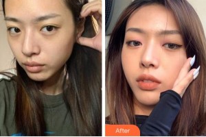 四川華美紫馨醫(yī)學(xué)美容醫(yī)院王小玉整形價格表附埋線提升案例展示