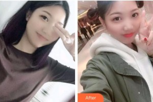 自貢維樂新橋口腔門診部田玉霞整形價格表附根管調節(jié)案例展示