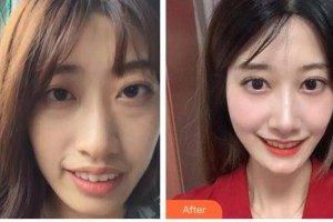 自貢維樂新橋口腔門診部陳琳整形價格表附牙齒陶瓷矯正案例展示