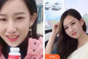 攀枝花奇麗整形美容醫(yī)院李宏整形價格表附牙齒隱形矯正案例展示