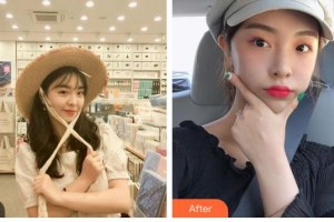 攀枝花市中心醫(yī)院燒傷整形美容科劉大海整形價格表附熱拉提案例展示