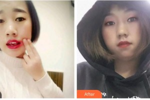 攀枝花博愛門診部楊軍整形價格表附口腔矯正案例展示