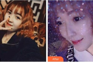 德陽(yáng)維樂(lè)新橋口腔門(mén)診部孫玉楓整形價(jià)格表附超聲波潔牙案例展示