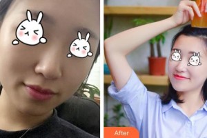 綿陽(yáng)整形美容醫(yī)院任林森整形價(jià)格表附無(wú)針?biāo)獍咐故?>
</a>
<h3 class=