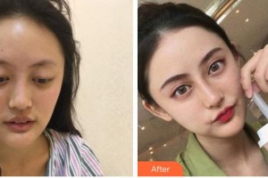 綿陽東美奧拉克醫(yī)療美容門診部黃國強整形價格表附鼻部綜合案例展示