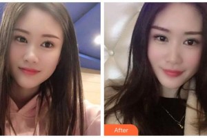 廣元口腔醫(yī)院胡澤勇整形價格表附冷光美白案例展示