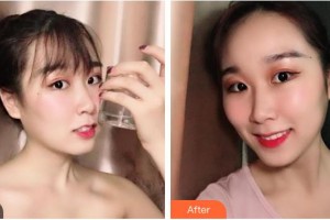 廣元口腔醫(yī)院馬林整形價格表附牙齒隱形矯正案例展示