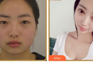 內江韓美醫(yī)療美容門診部趙君海整形價格表附眼部綜合案例展示