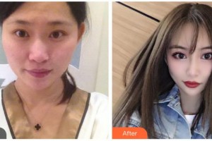 樂山愛爾眼科醫(yī)院宋德智整形價(jià)格表附眼部綜合案例展示