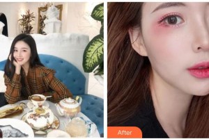 南充嬌美傾城醫(yī)學(xué)美容門診部張偉整形價(jià)格表附眼部綜合案例展示