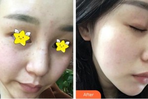 南充五星美容整形門診部楊建國整形價(jià)格表附激光美膚激光案例展示