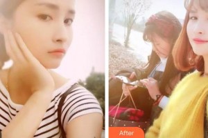 南充美佳口腔診所王永文整形價(jià)格表附牙齒隱形矯正案例展示