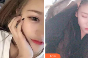 深圳德貝美口腔門診部賴宏生整形價格表附冷光美白案例展示