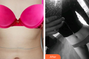 深圳福雅醫(yī)學美容門診部胡俊杰整形價格表附美體塑形案例展示