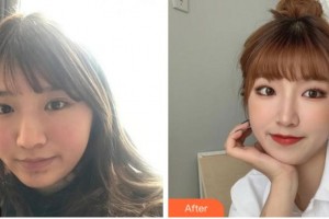 宜賓市第一人民醫(yī)院整形燒傷科張攀整形價(jià)格表附激光祛斑案例展示