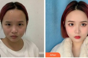 達(dá)州海博醫(yī)學(xué)美容醫(yī)院歐海云整形價格表附激光祛斑案例展示