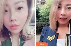 巴中華醫(yī)口腔醫(yī)院母汶靈整形價格表附牙齒隱形矯正案例展示