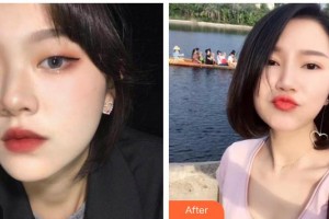 湖南博雅眼科醫(yī)院龔凌整形價(jià)格表附眼部綜合案例展示