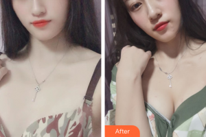 珠海市人民醫(yī)院燒傷整形綜合科張先安整形價(jià)格表附自體脂肪隆胸案例展示