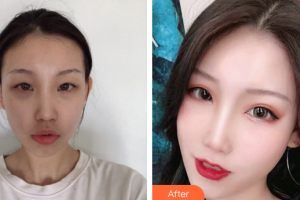 珠海科美醫(yī)療美容醫(yī)院金俊浩整形價(jià)格表附眼部整形案例展示