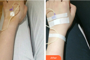 珠海九龍醫(yī)院醫(yī)學(xué)美容科傅仙香整形價(jià)格表附注射美白案例展示